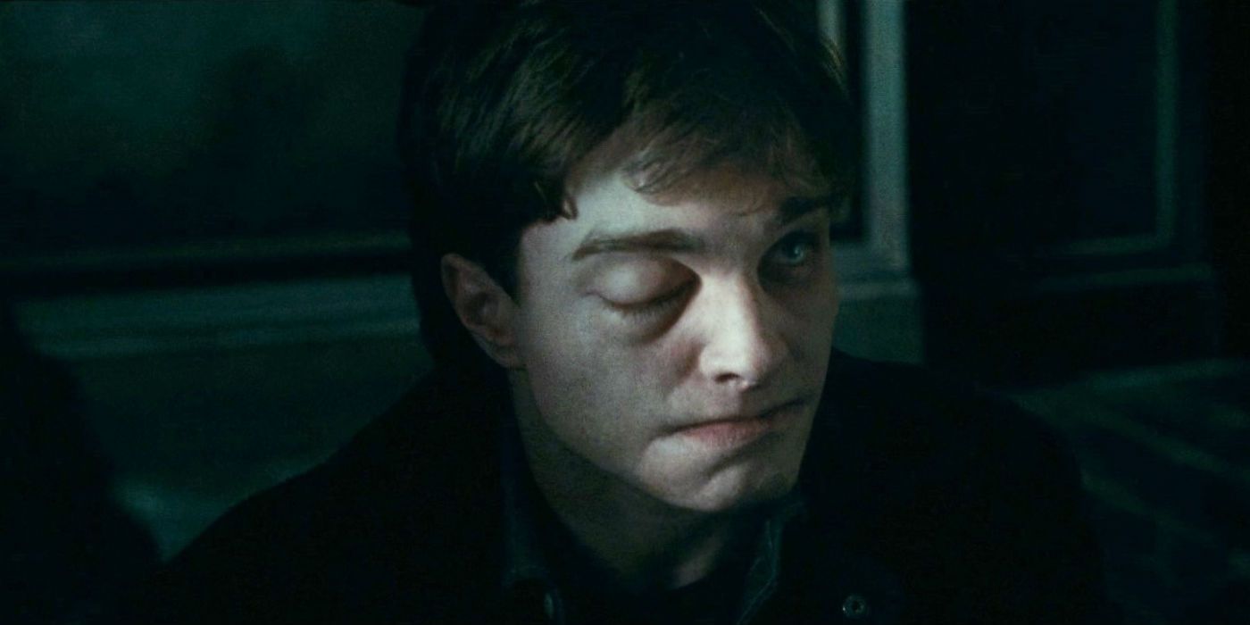 Daniel Radcliffe as Harry Potter Affected By the Stinging Jinx in Harry Potter and the Deathly Hallows