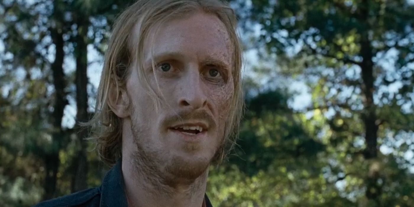 Dwight of the Saviors from Walking Dead with Burnt Face