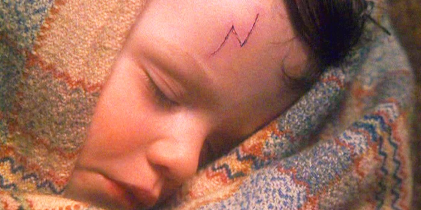 Baby Harry Potter Scar