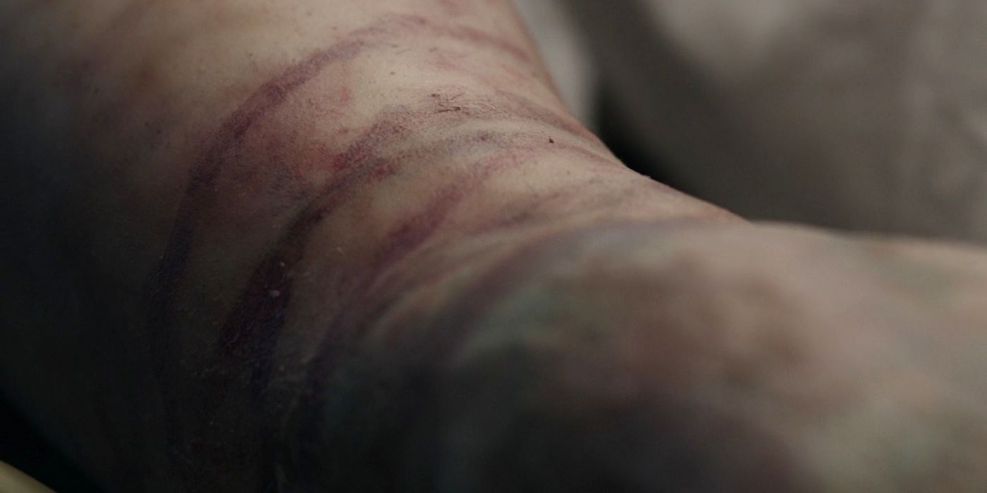 Riverdale - Jason Blossom's body - ligature marks