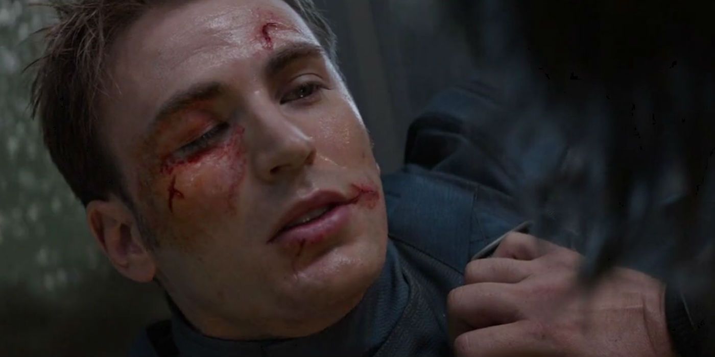 Steve with wounds on his face in Captain America: The Winter Solider