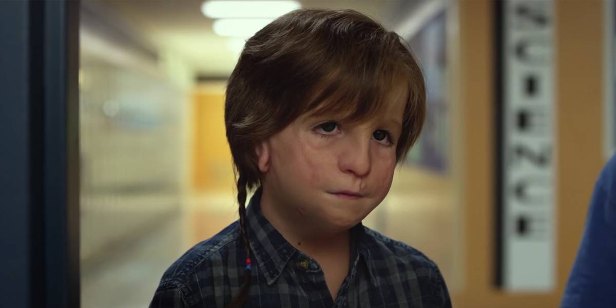 Jacob Wonder Auggie From Wonder Actor 60 Photos - Moonagedaydream.film