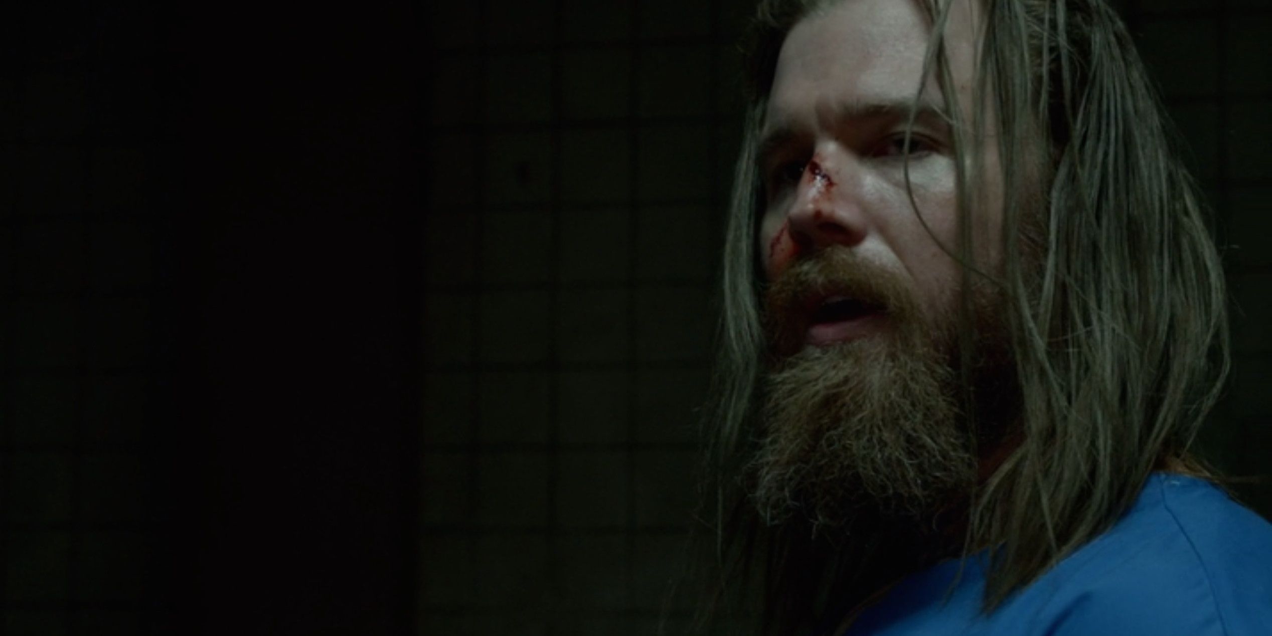 Opie bloodied in Sons Of Anarchy