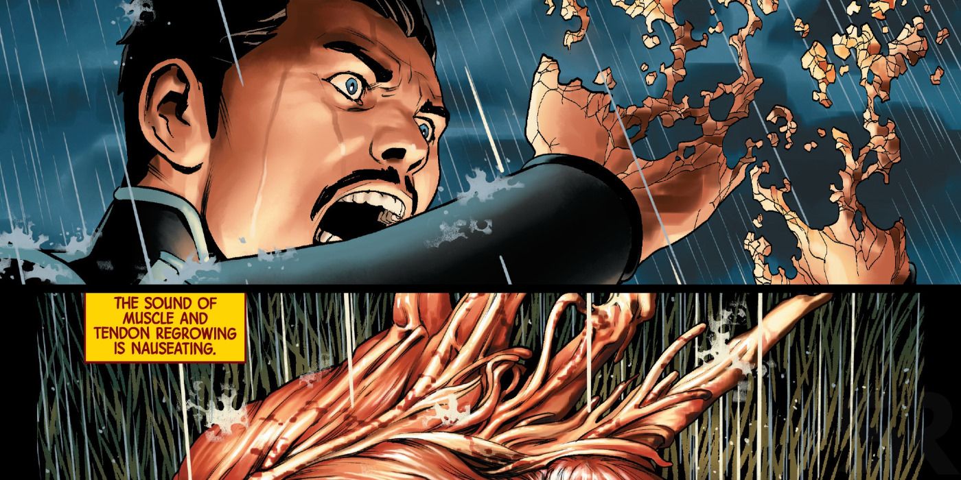 Doctor Strange Healed Hands Regrow