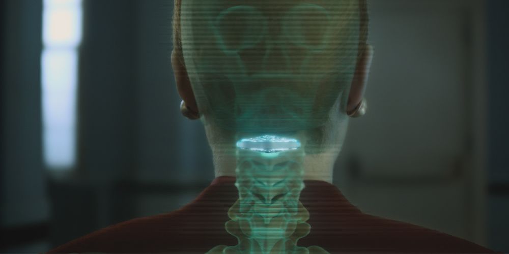 Cortical stack
