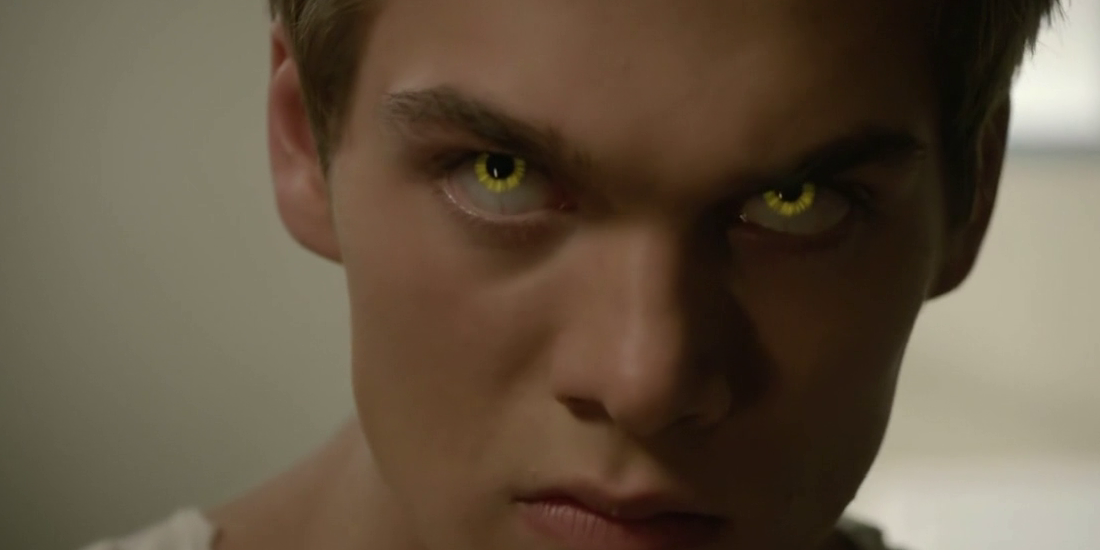 Liam's eyes change yellow in a close up in Teen Wolf