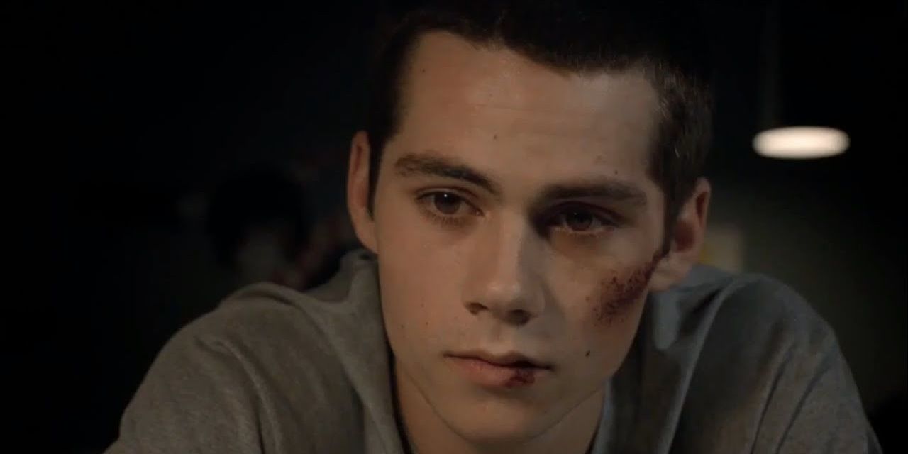 Stiles looks forlorn with bruises on his face in Teen Wolf