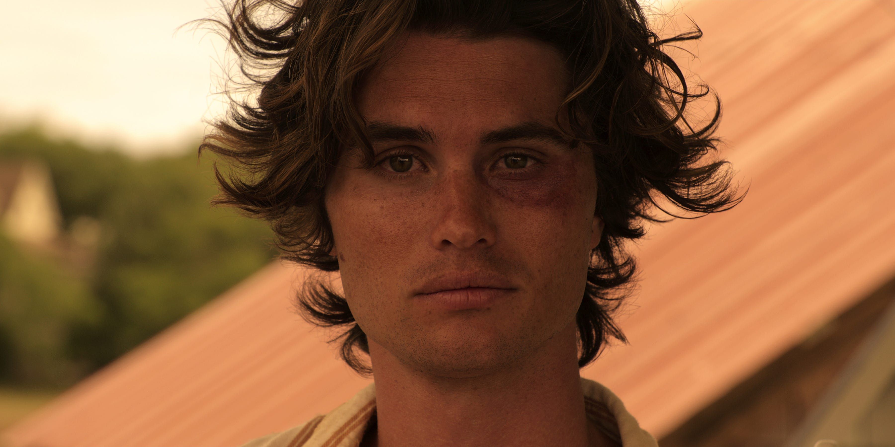 A closeup of John B with a black eye in season 1 of Outer Banks