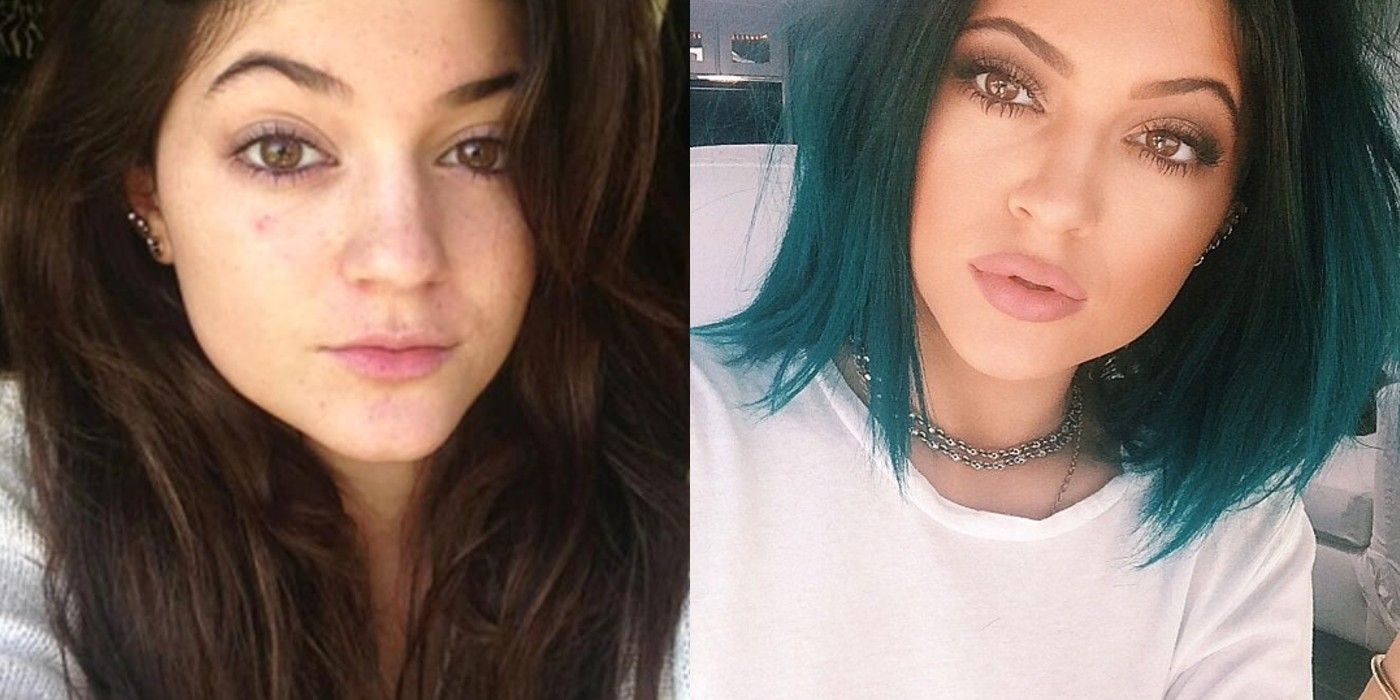 Keeping Up With the Kardashians Kylie Jenner Before and After Pics