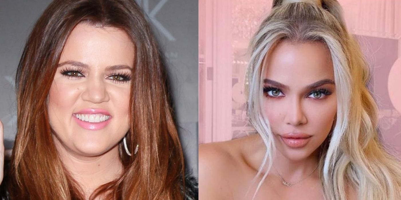 Kuwtk What Khloe Kardashian Looks Like Before And After The Operation 