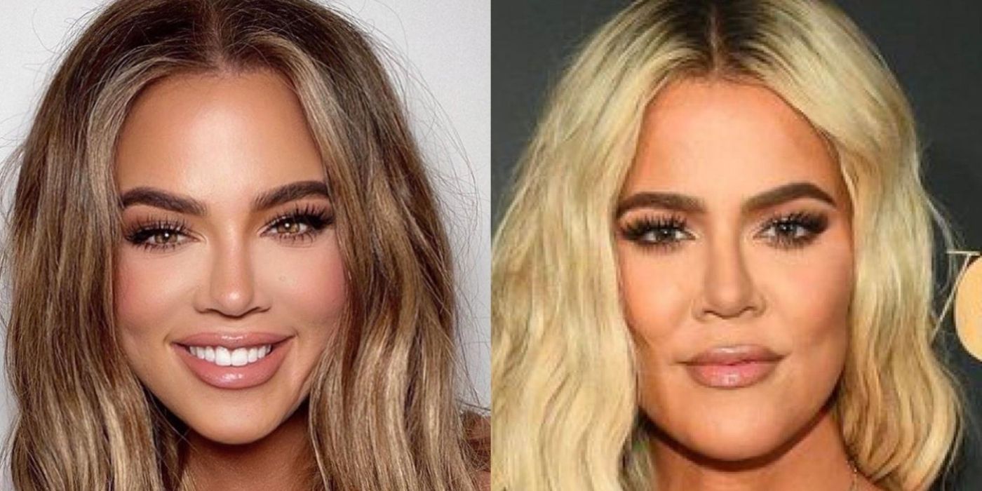 Khloe Kardashian Before And After Nose