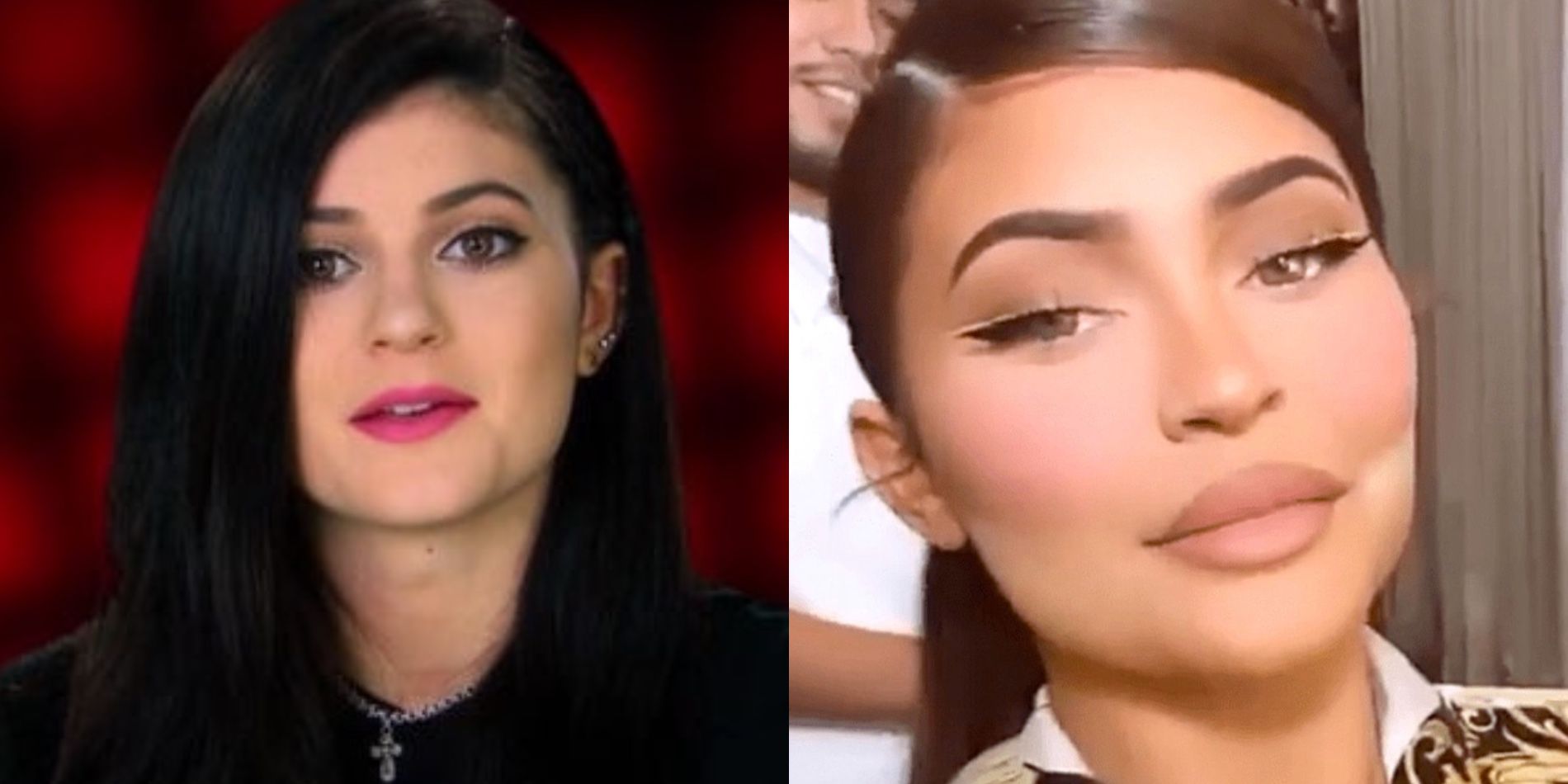 Keeping Up With The Kardashians Kylie Jenner Plastic Surgery Timeline
