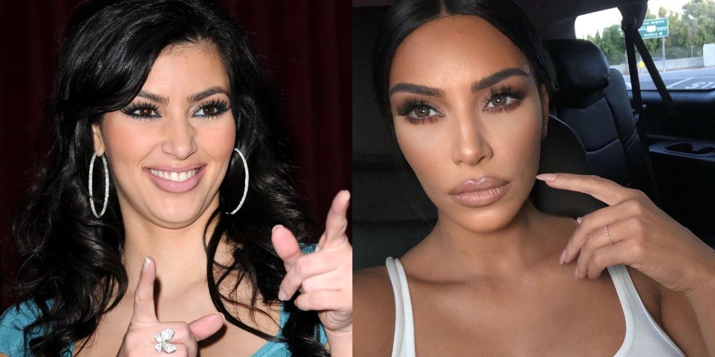 Kim Kardashian: Plastic Surgery:: Keeping Up with the Kardashians