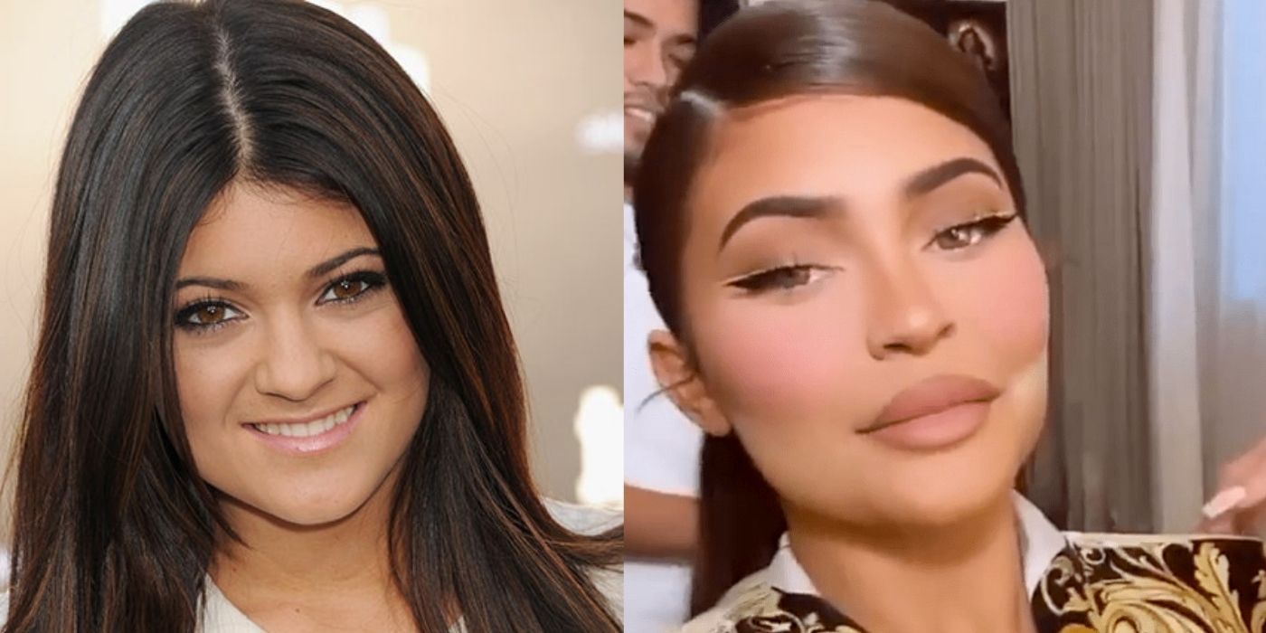 Kylie Jenner before and after photos