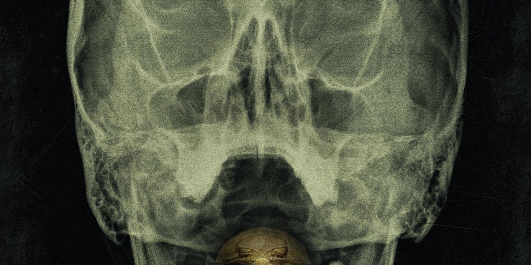 The bay's poster featuring an X-Ray of a huamn skull.