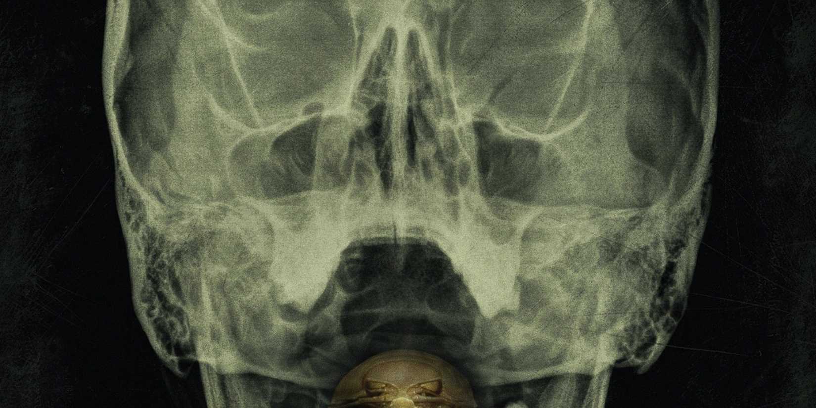 The bay's poster featuring an X-Ray of a huamn skull.