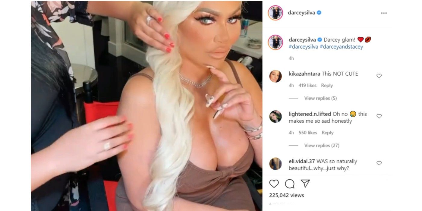 Darcey and Stacey Filter Plastic Sugery Before Turkey Photoshop Instagram In 90 Day Fiance