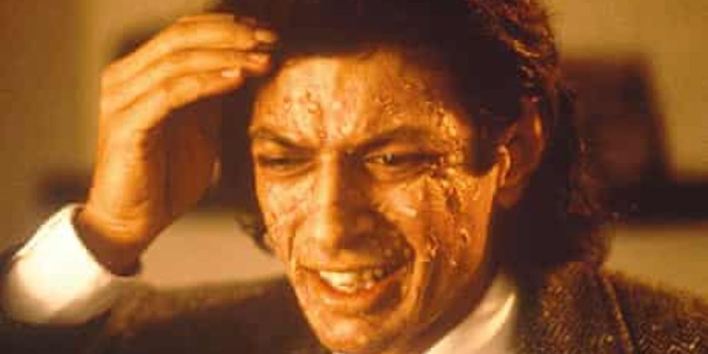 Jeff Goldblum in The Fly with a hand to his head, his skin is peeling and blistered