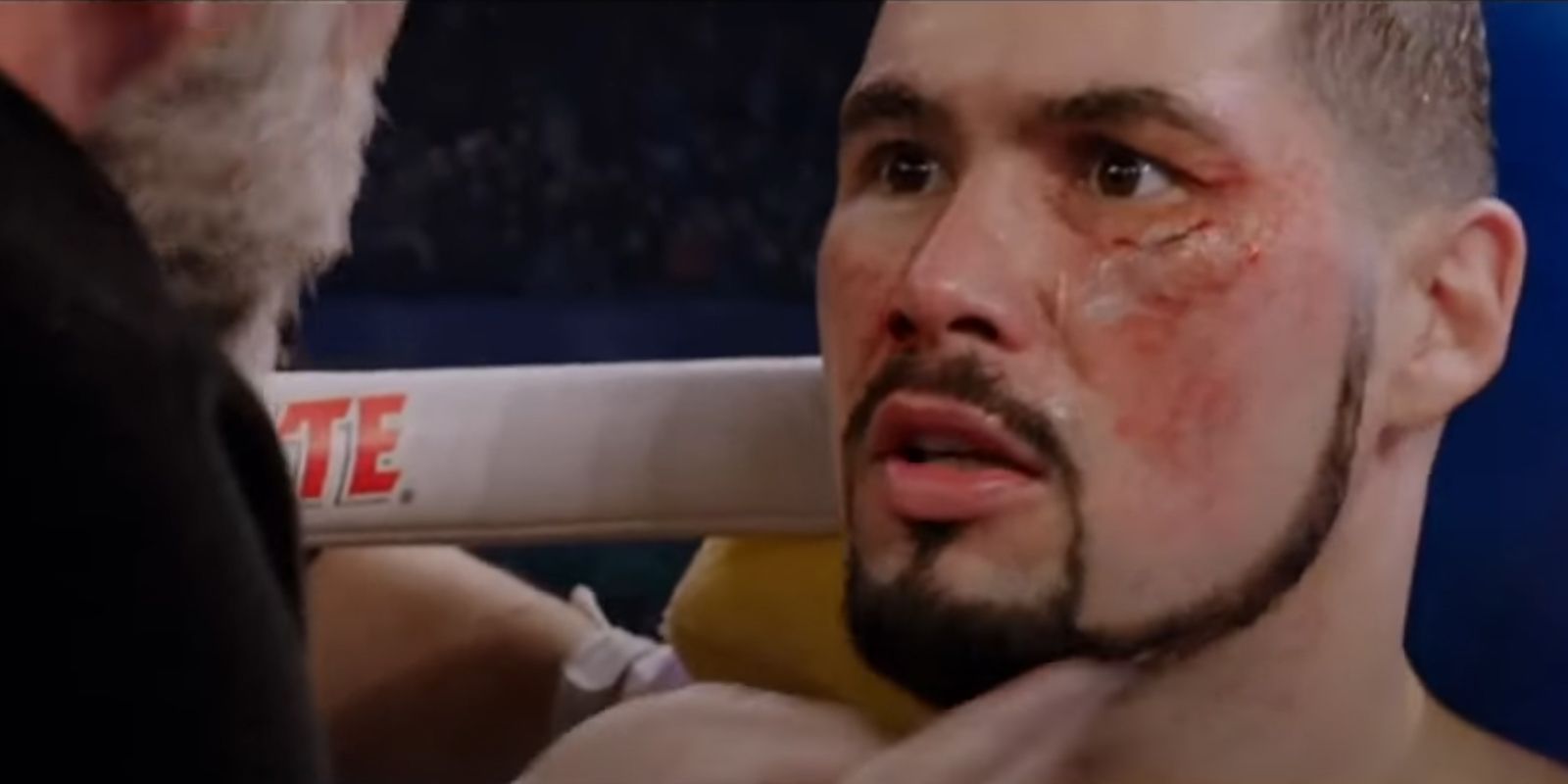 Pretty Ricky Conlan looking stunned in his corner in Creed 2015