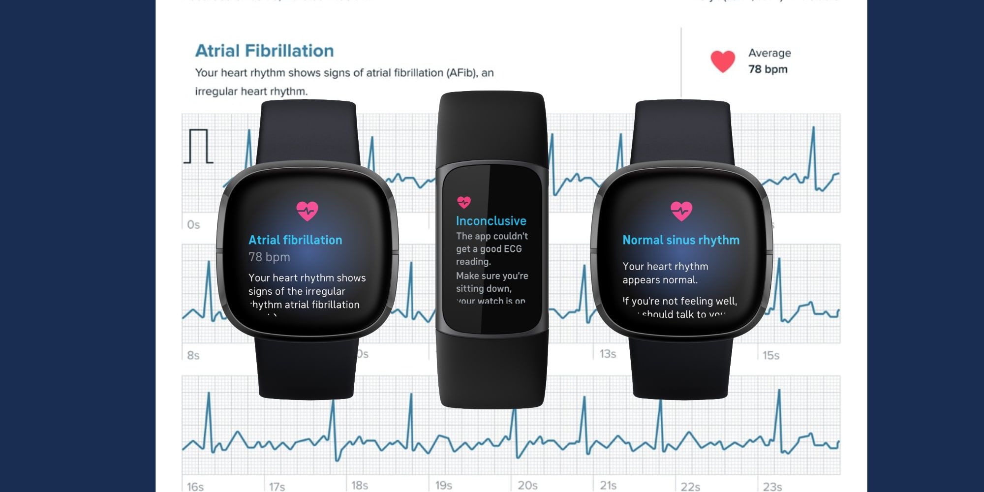 Fitbit Sense And Fitbit Charge 5 ECG Results Report Assessment