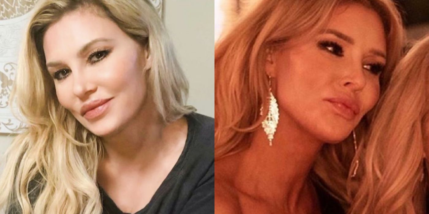 A split image of Brandi Glanville and her plastic surgery from RHOBH