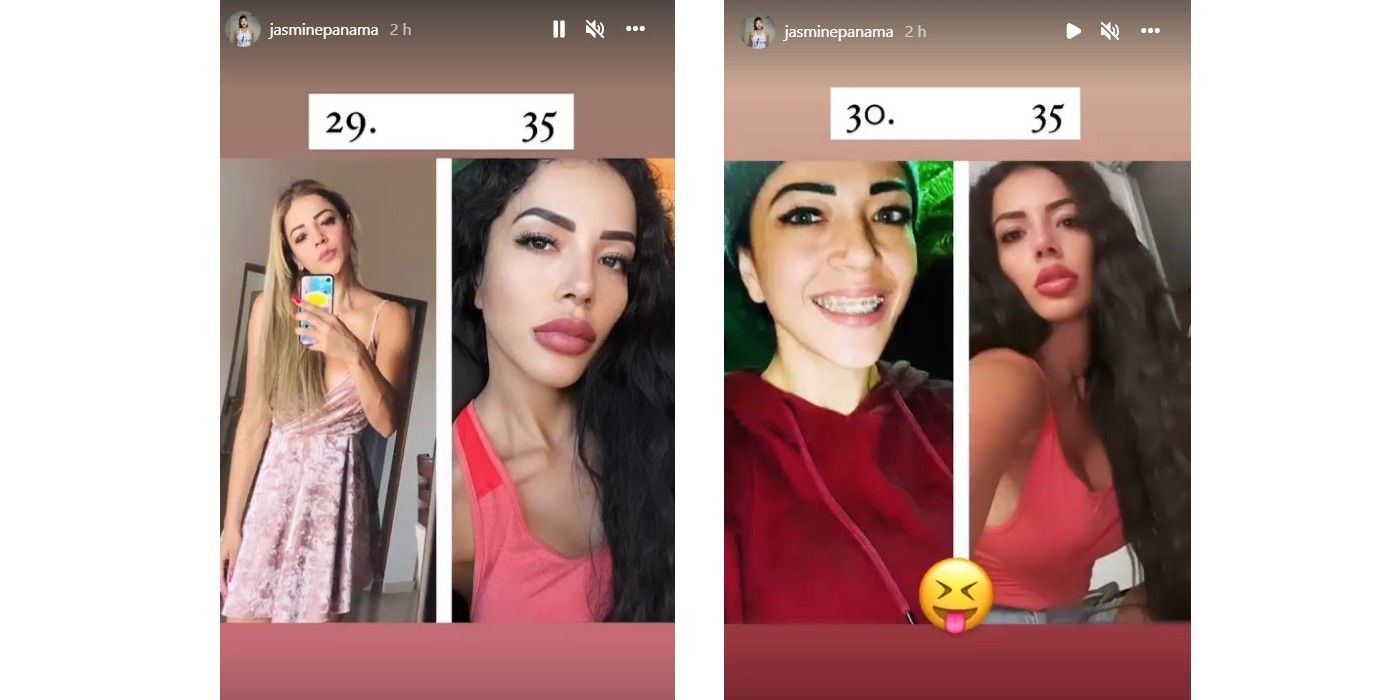Jasmine Before After Throwback Surgery Instagram In 90 Day Fiance