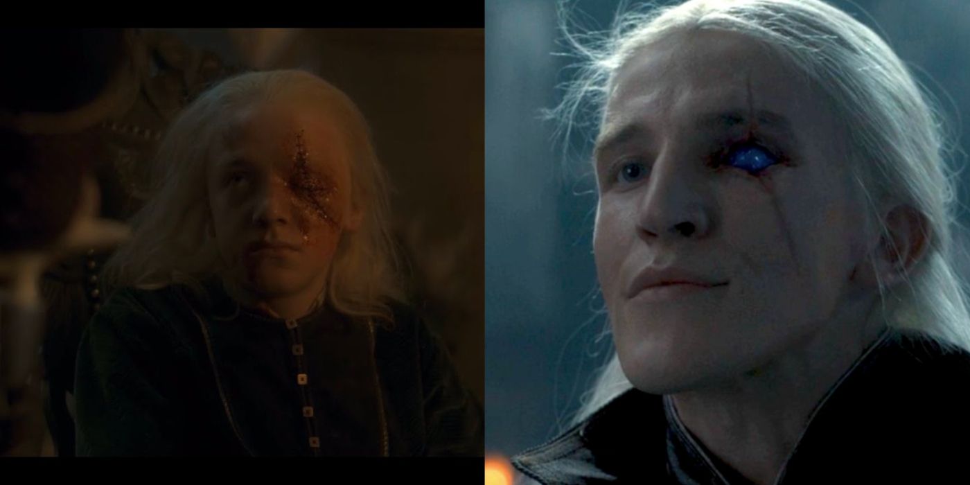 Aemond Targaryen young missing an eye alongside an image of older Aemond without his eye patch and a blue eye from House of the Dragon. 