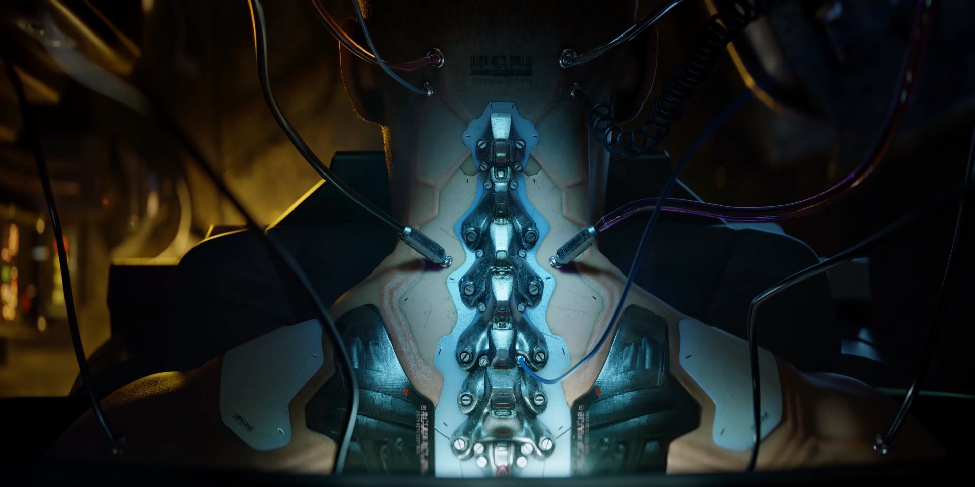 Spinal cybernetics getting implanted on a Cyberpunk character.