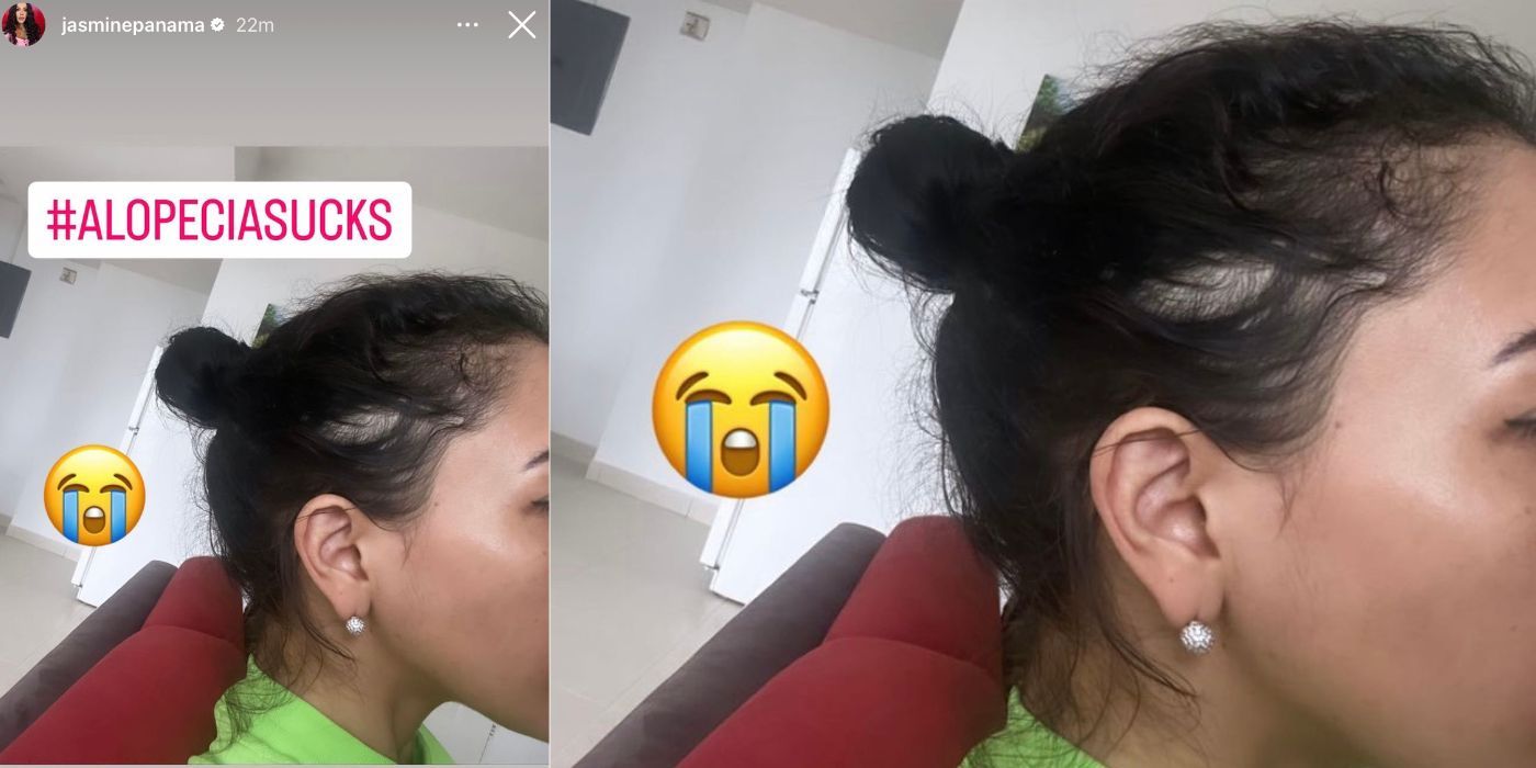 90 Day Fiancé star Jasmine Pineda&rsquo;s hair loss in an Instagram Story