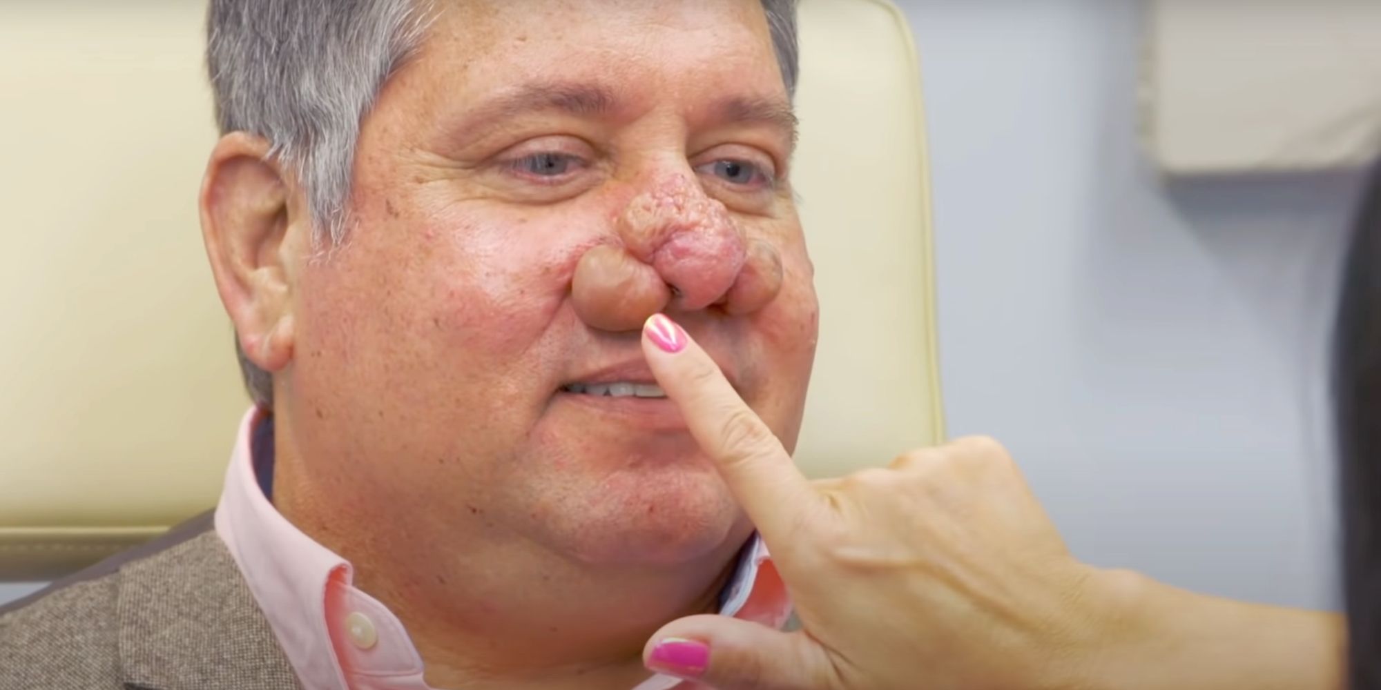 Dr Pimple Popper Tony Rinofima