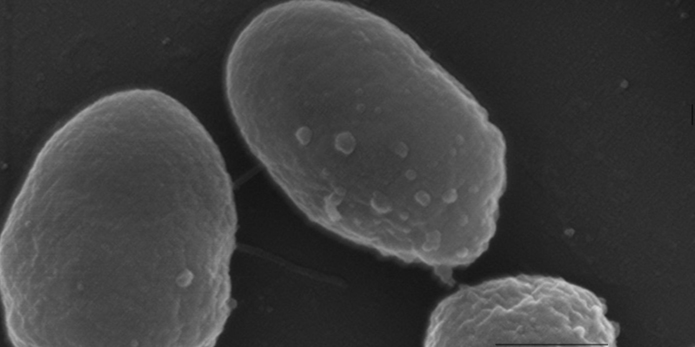 Bioengineered bacteria strain that will upcycle plastic into usable material during spade missions pictured under a microscope