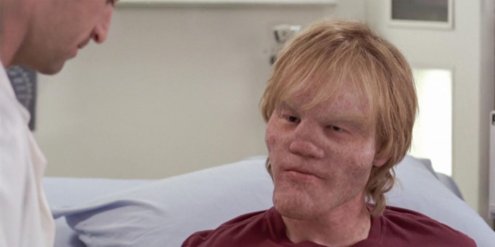 Jesse Plemons as Jake Burton, a teenager with a tumerous face in Grey's Anatomy Episode