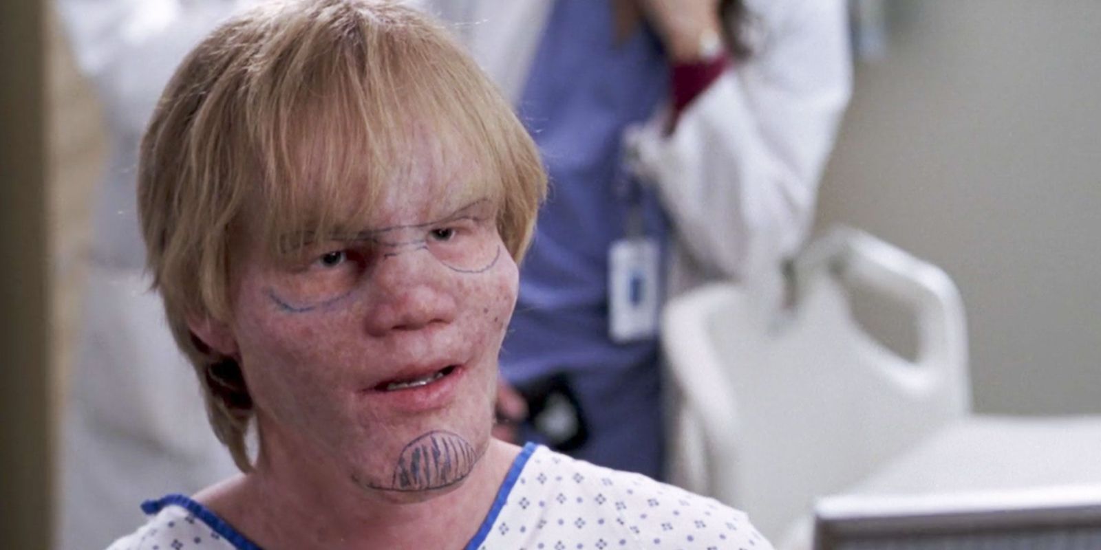 Jesse Plemons as Jake Burton in Grey's Anatomy with marker on his face. 