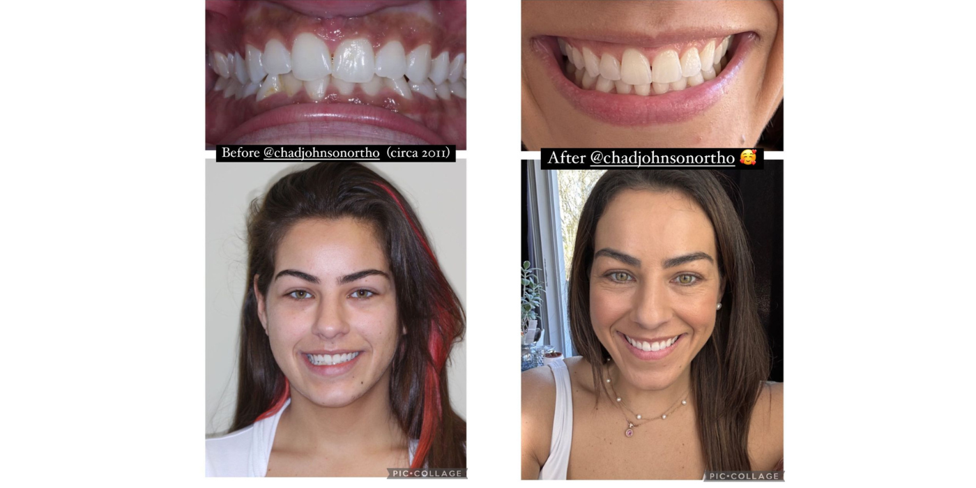 90 Day Fiancés Veronica Reveals Before And After Smile Makeover Photos 0281