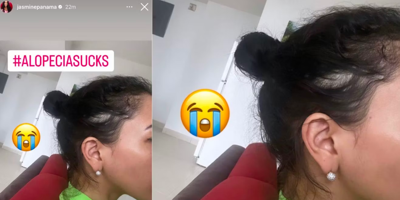 90 Day Fiancé star Jasmine Pineda shares details about hair loss on Instagram