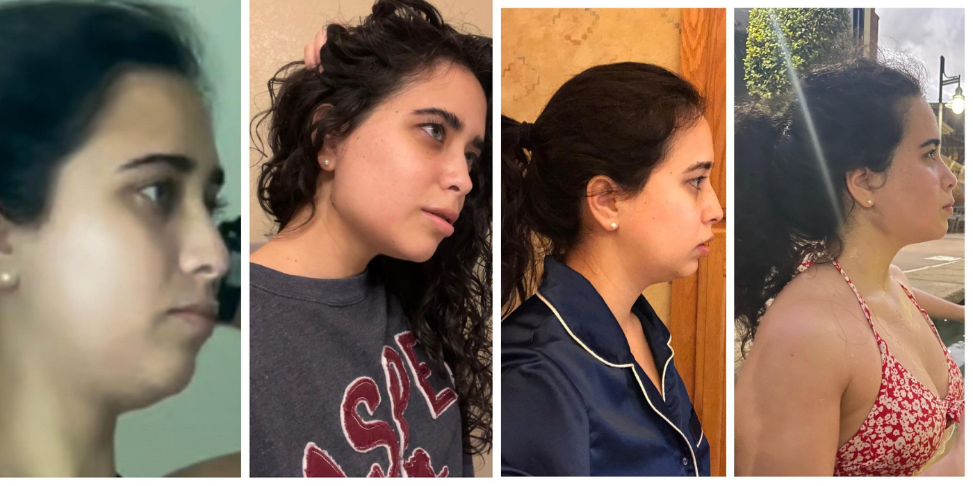 90 Day Fiancé- Before &amp; After Photos Of Statler Riley&rsquo;s Shocking Jaw Replacement Surgery 2