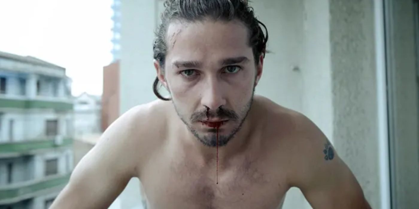 Charlie Countryman with a bloody nose