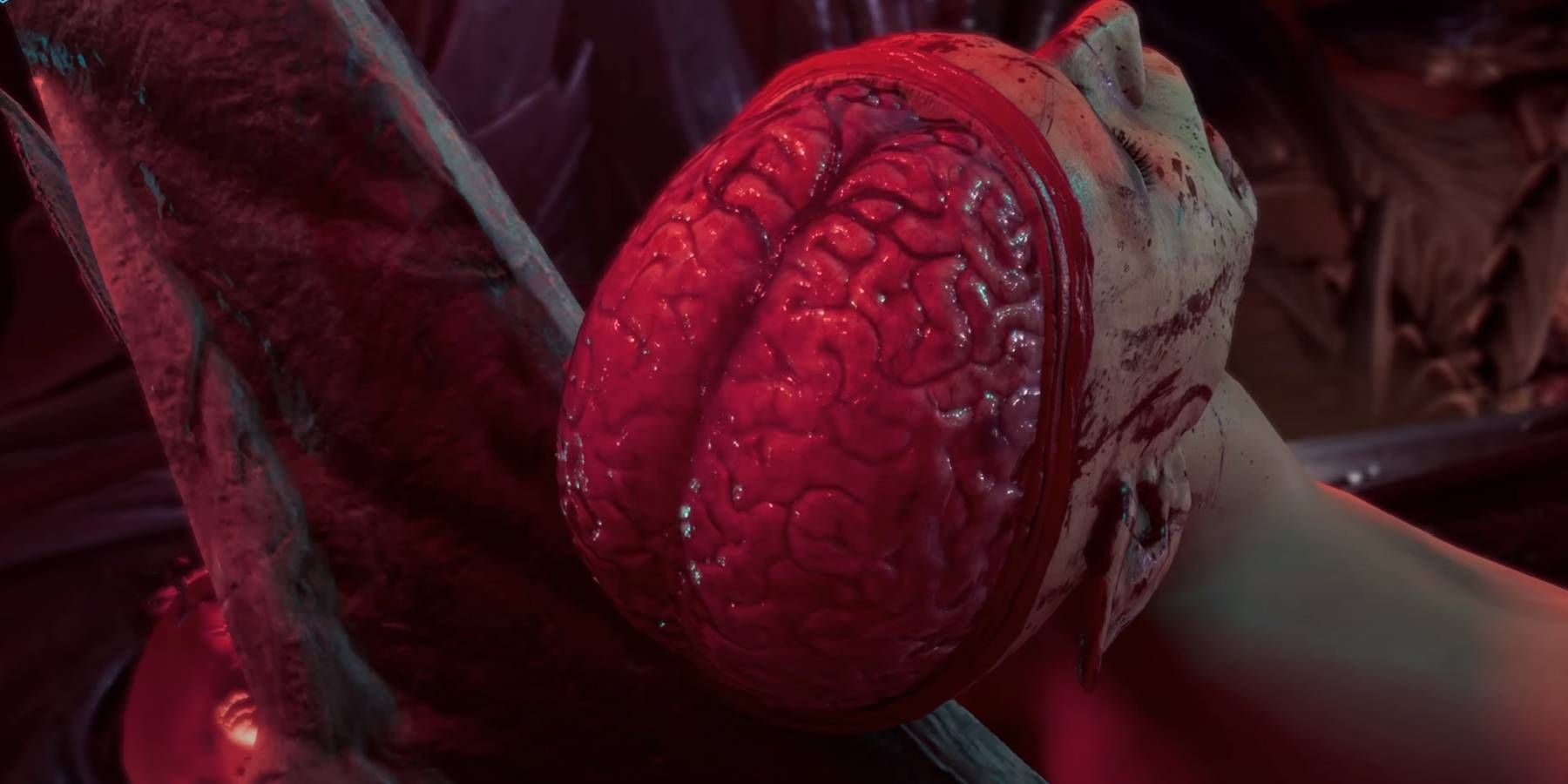 An exposed brain in Baldur's Gate 3.