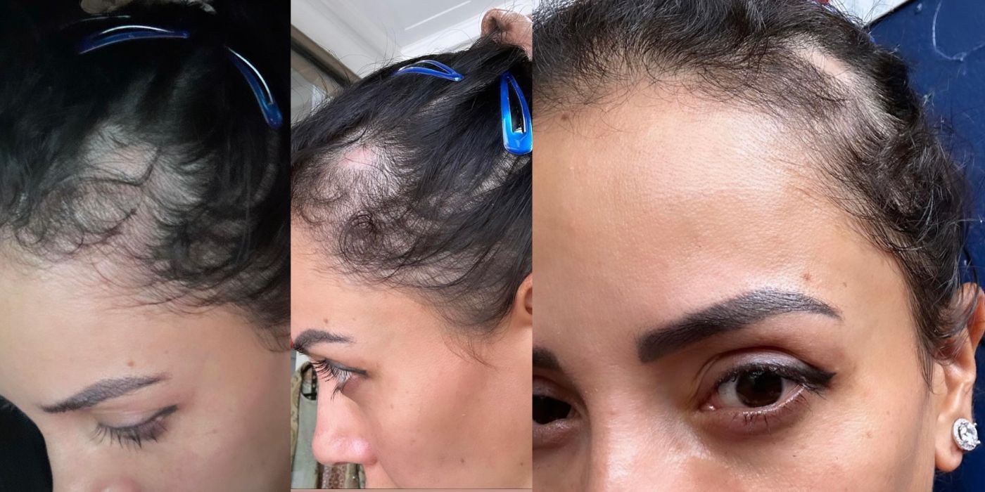 90 Day Fiance star Jasmine Pineda&rsquo;s Instagram Stories about alopecia