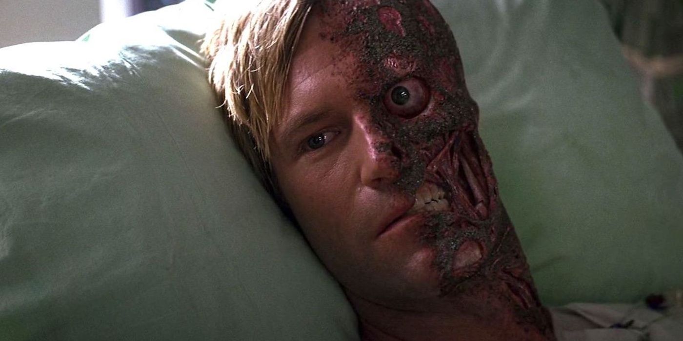 Aaron Eckhart's Two-Face lays in a hospital bed in The Dark Knight