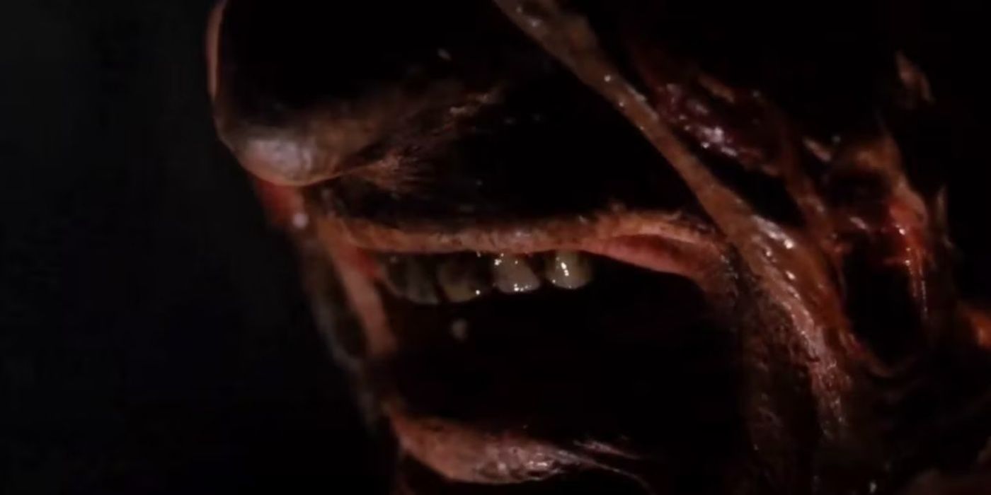 A close up of Freddy Krueger's teeth.