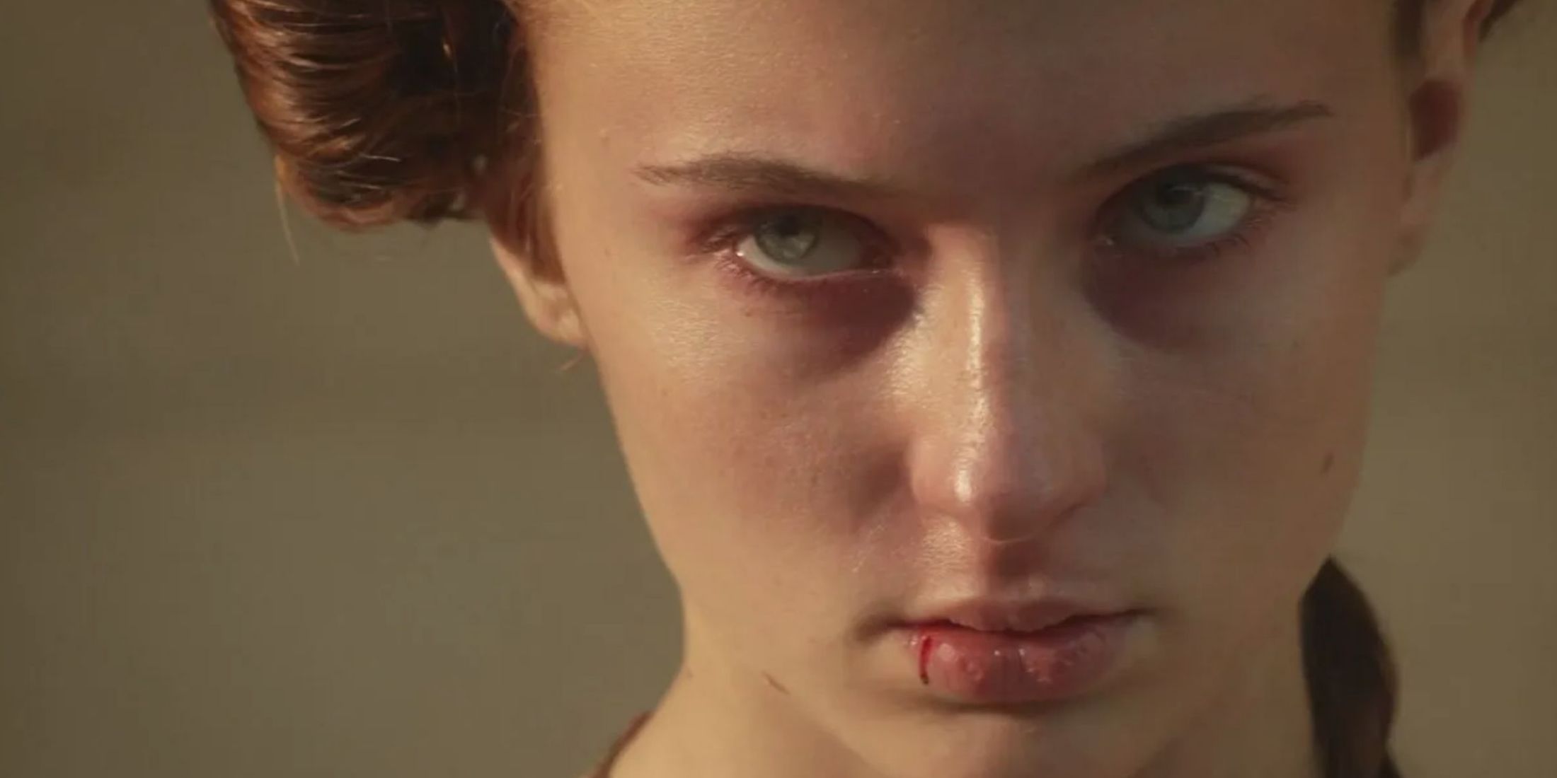 Sansa Stark is looking angry with a bloody lip in Game of Thrones.