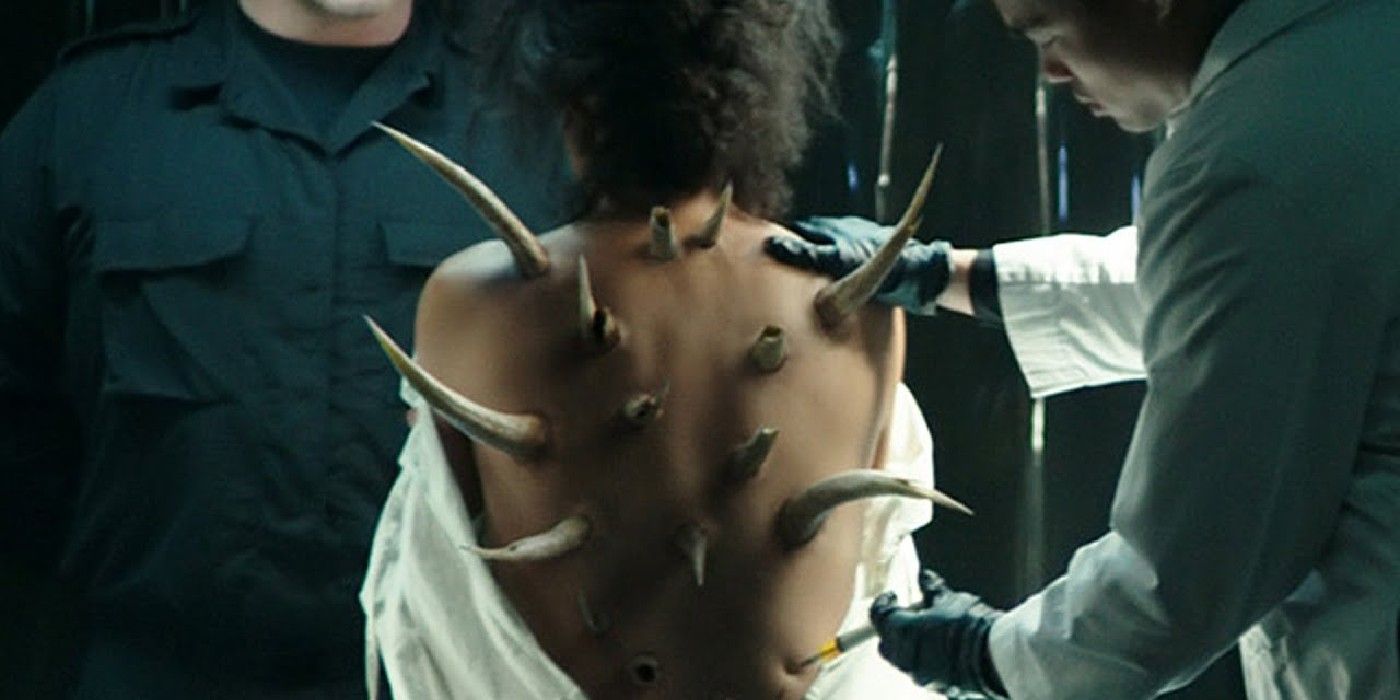 Marrow being experimented on in Deadpool