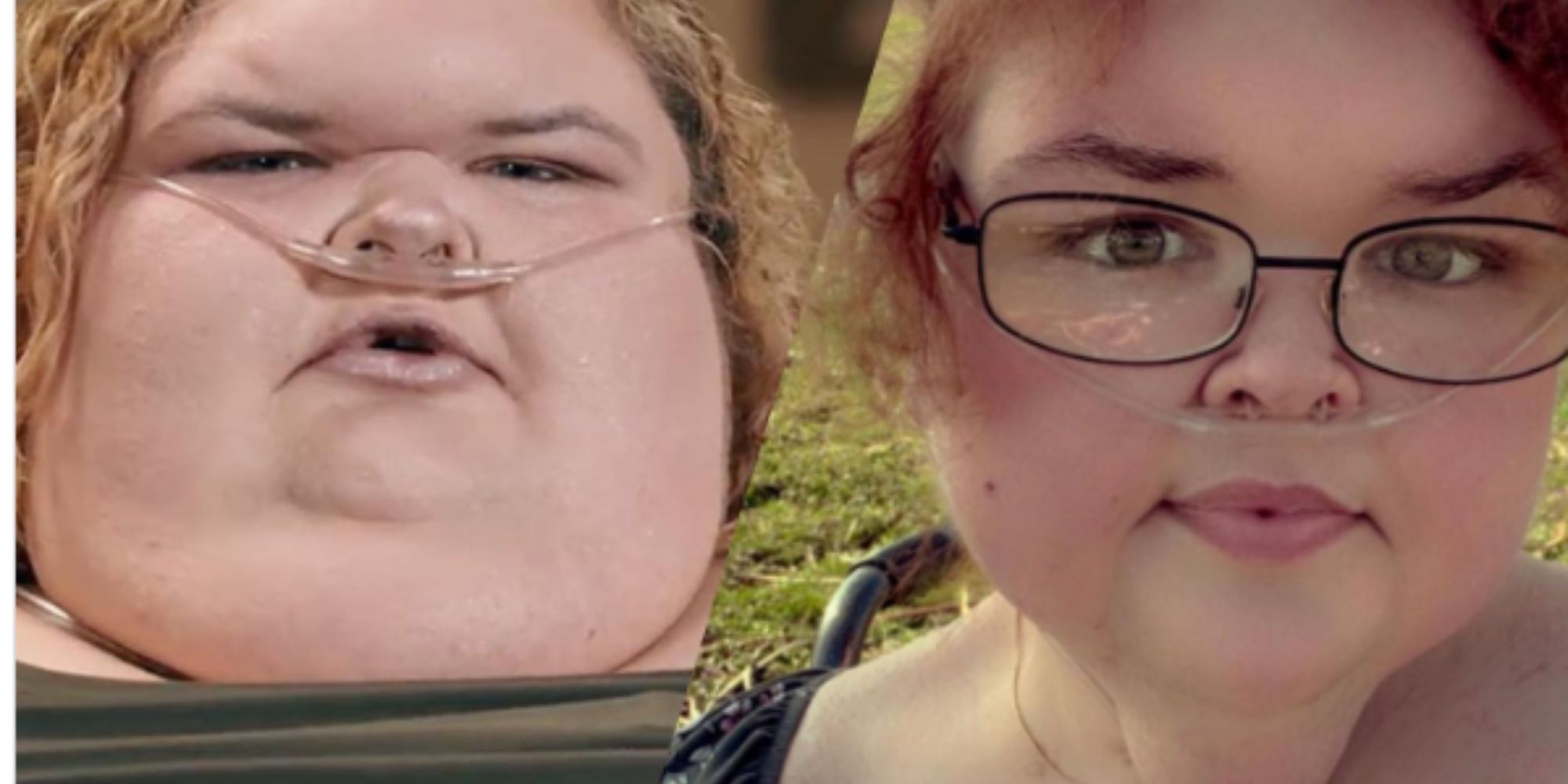 1000-lb sister tammy slaton before and after side by side split screen
