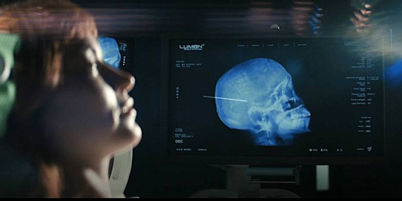 Britt Lower undergoing surgery as Helly in Severance season 1