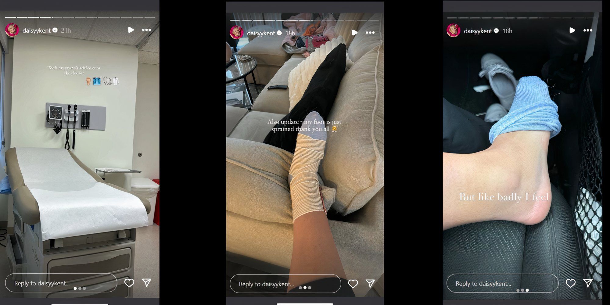 Daisy Kent Instagram Story Screen Shots - Injured Foot