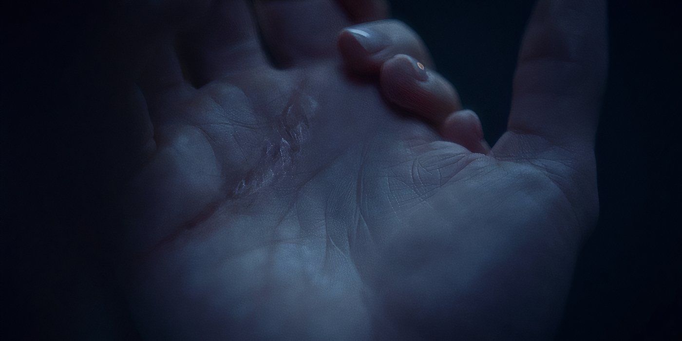 Scar on Carmy's hand in The Bear season 4