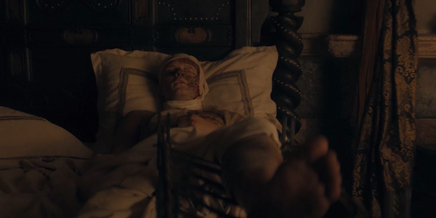 Aegon bedridden and covered in bandages in House of the Dragon season 2