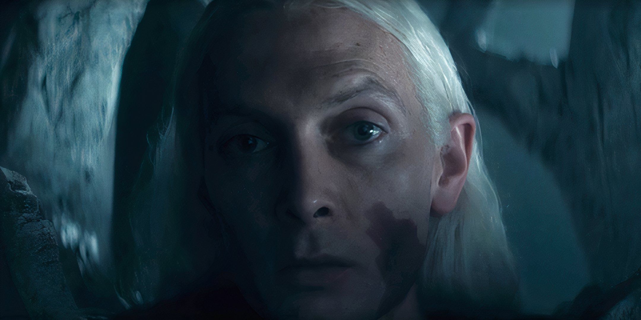 Close-up of Brynden Rivers, with a red birthmark, in House of the Dragon season 2, episode 8