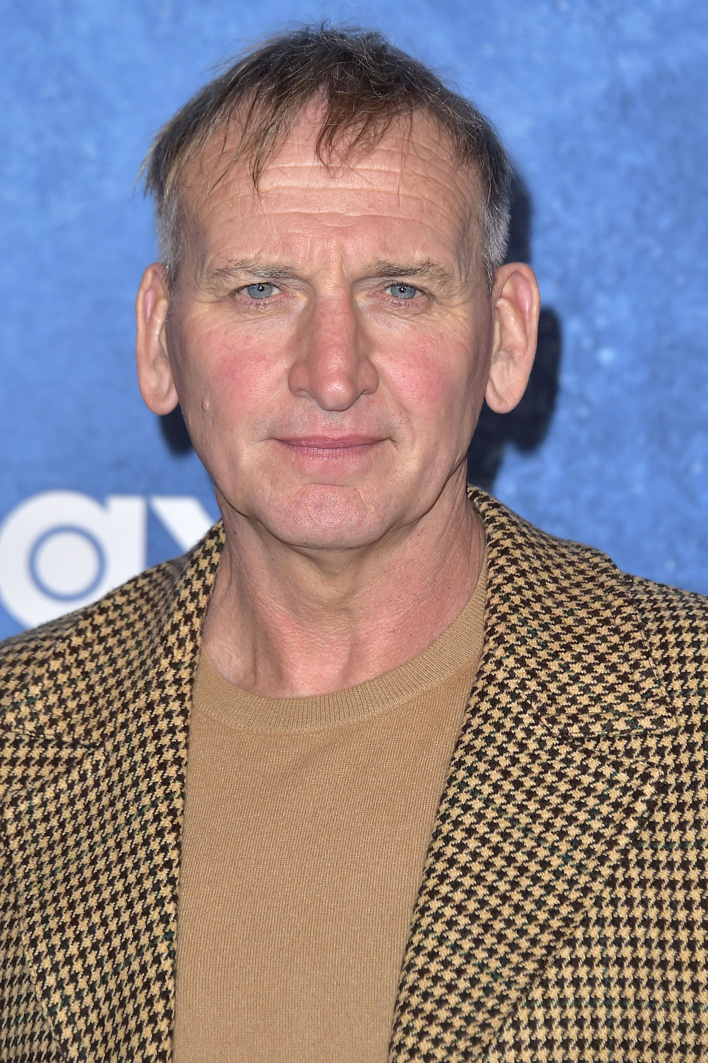 Tiro na cabeça de Christopher Eccleston